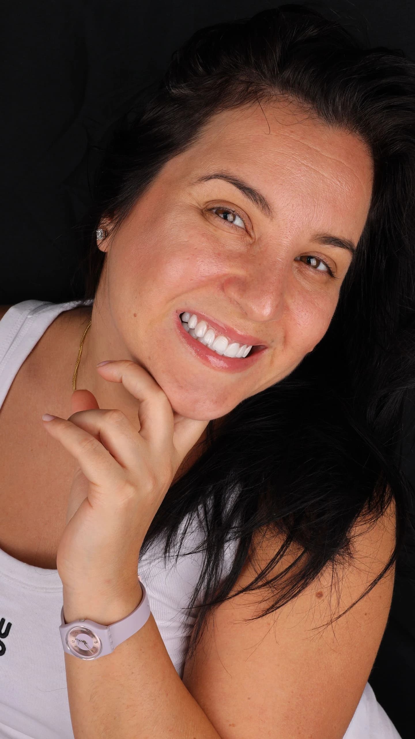 Patient smile result 37