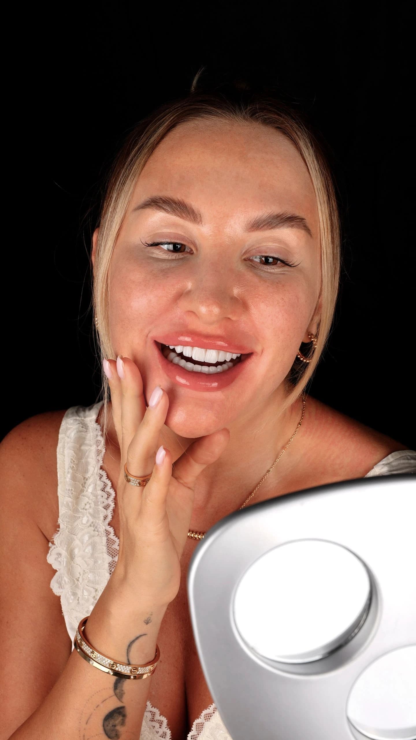 Patient smile result 20