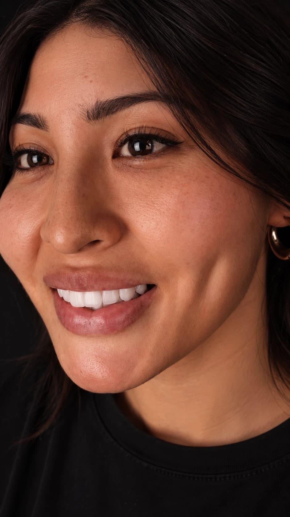 Patient smile result 17